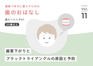 歯茎下がり・ブラックトライアングルの原因と予防